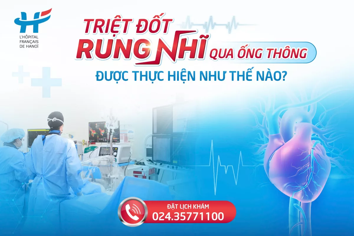 Triệt đốt rung nhĩ qua ống thông được thực hiện như thế nào?